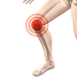 日常の膝の痛みについて考えましょう！