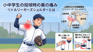 小中学生の投球時の肩の痛み ― リトルリーガーズショルダーとは